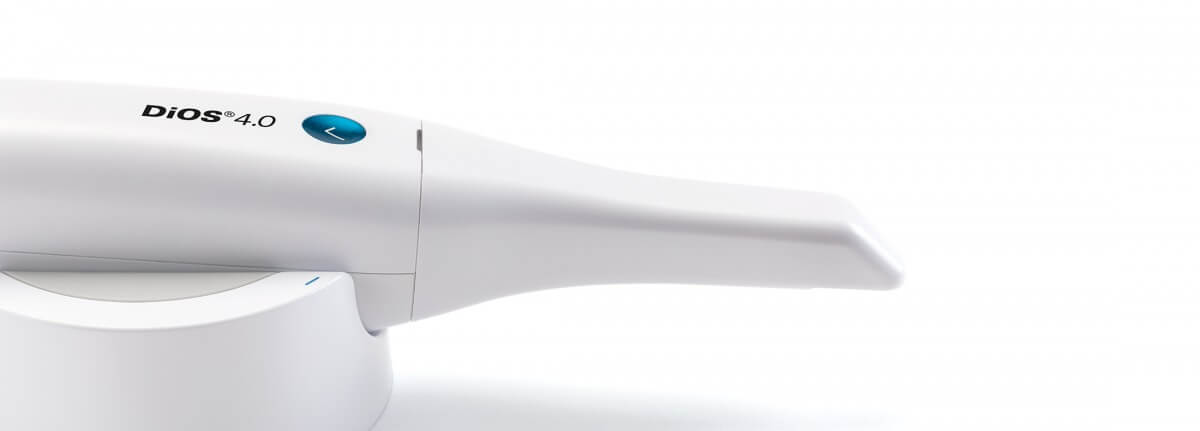 Intraorales Scannen – Der Würgereflex gehört der Vergangenheit an