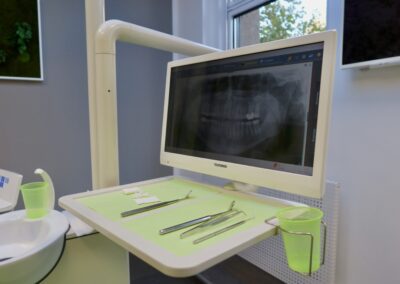 Röntgenbild auf Monitor und Behandlungstray bei Zahnarzt Dr. Pantas