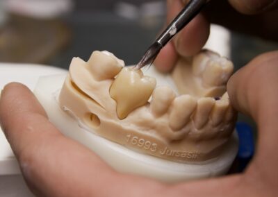 Zahnersatz-Keramikverblendung in Handarbeit im Dentallabor Dr. Pantas Düsseldorf