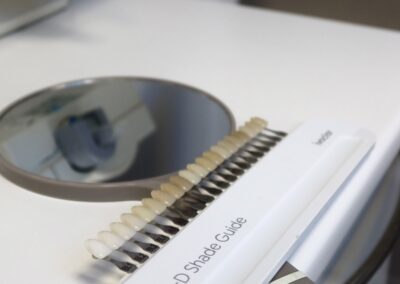 VITA Shade Guide Nahaufnahme bei Zahnarzt Dr. Pantas Düsseldorf